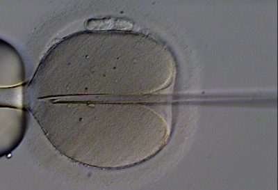 Thirty years ago, the very first ICSI baby was born in UZ Brussel