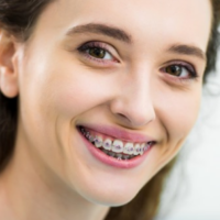 Can You Get Braces With Periodontal Disease
