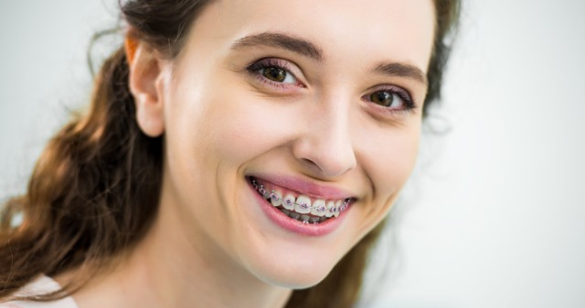 Can You Get Braces With Periodontal Disease