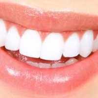How To Whiten Fake Teeth