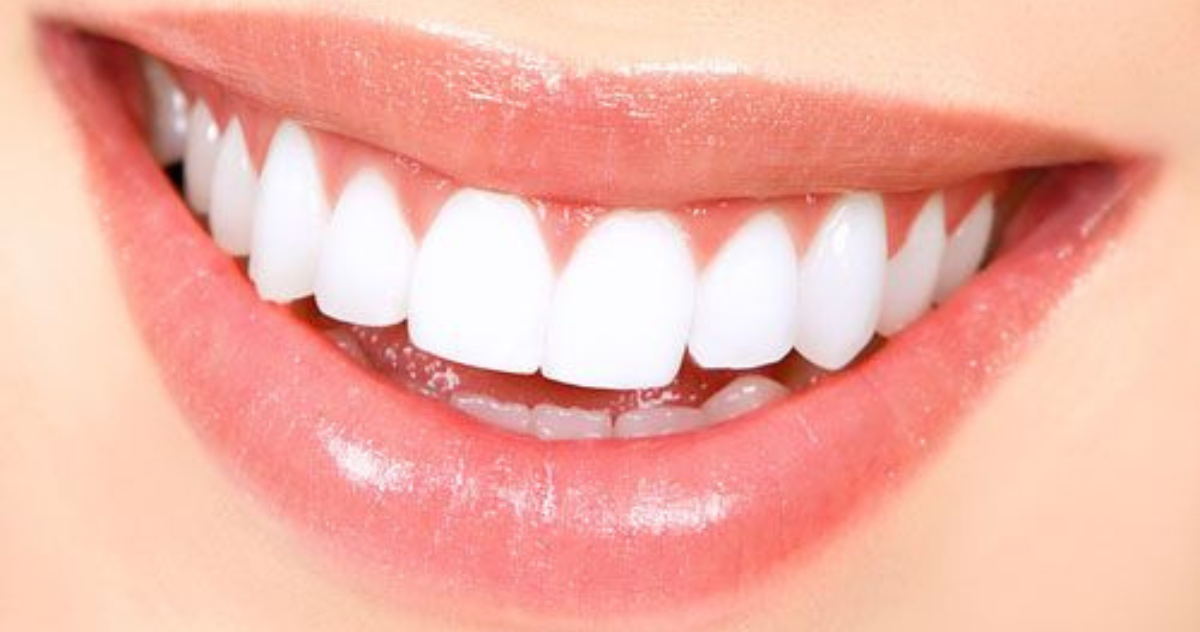 How To Whiten Fake Teeth
