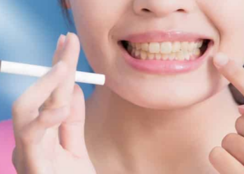 How To Remove Tobacco Stains From Teeth Instantly