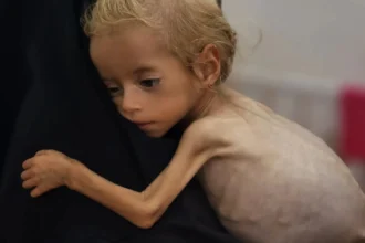 Gaza health ministry reports 100 children died of malnutrition