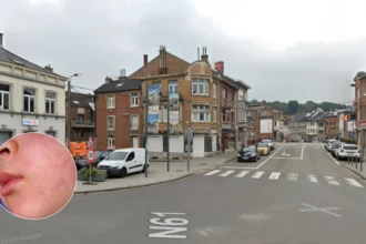 Measles outbreak hits 24 in Limburg, kids under 10 at risk