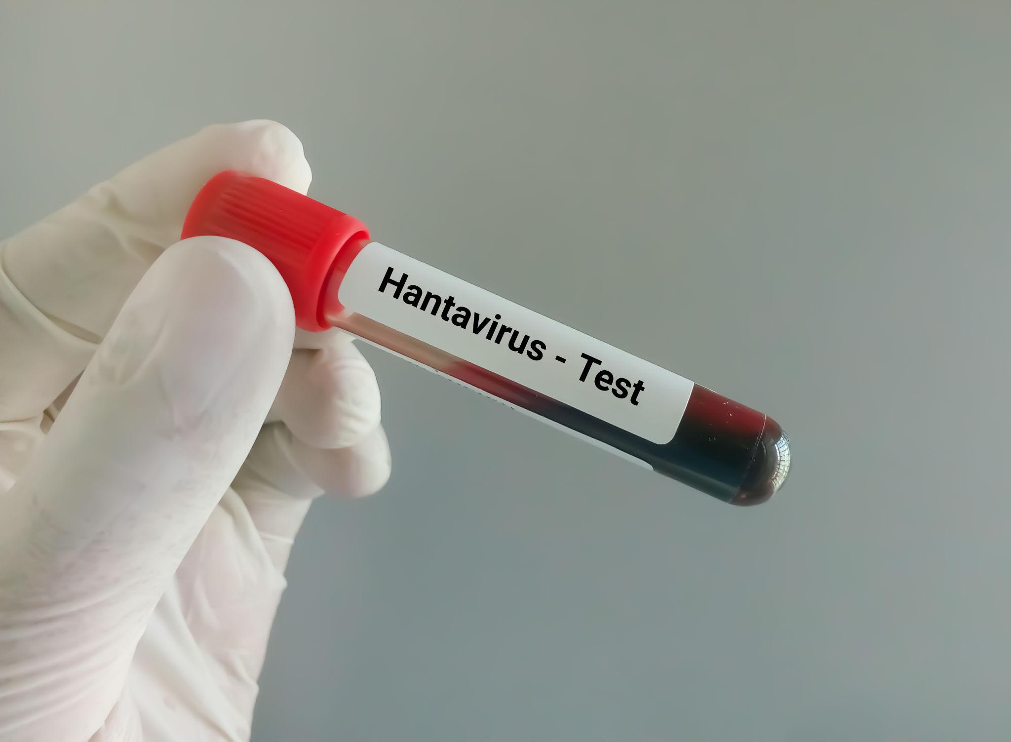 Health inspection aboard cruise ship linked to France hantavirus case