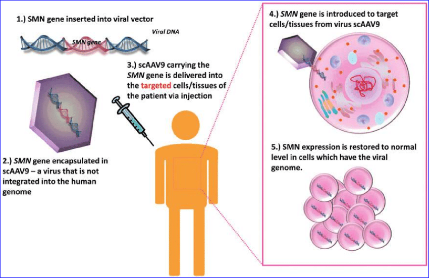 Medical genetics research advancing spinal muscular atrophy treatment