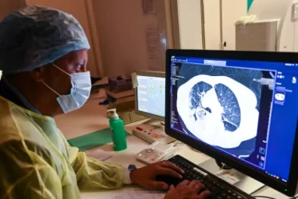 UZA early Lung Cancer test for smokers aged 55-74 in Antwerp 