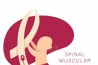 Spinal muscular atrophy treatment options and patient care