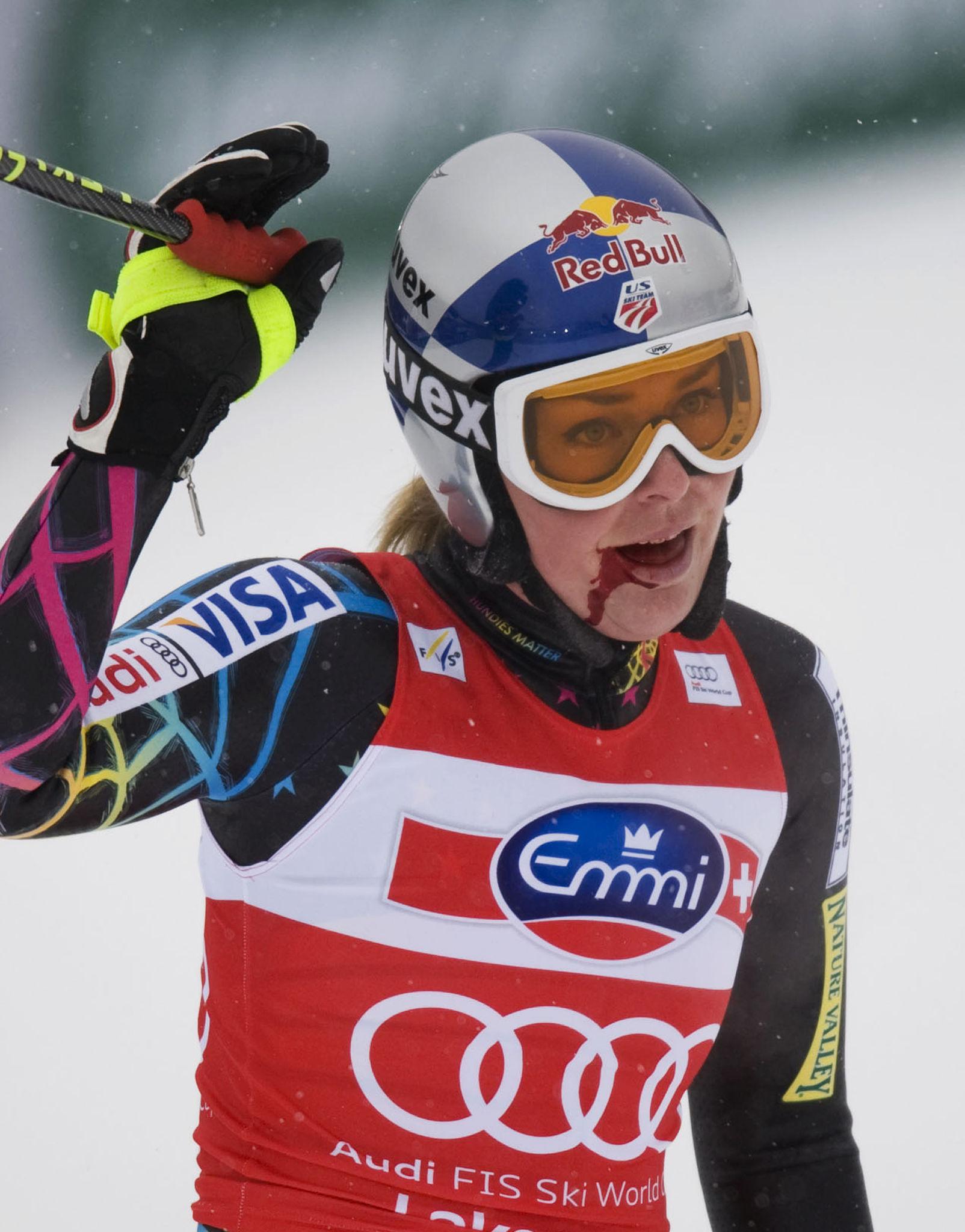 Ski racing crash highlights dangers of Alpine skiing in Cortina